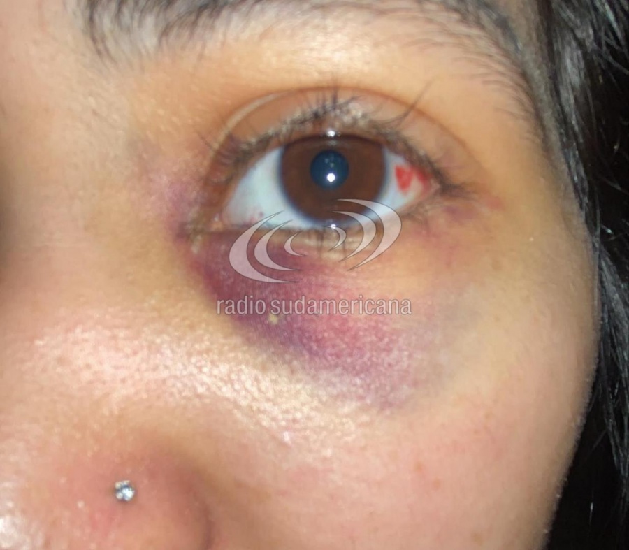 Corrientes: denuncian una violenta agresión entre alumnas dentro de una escuela